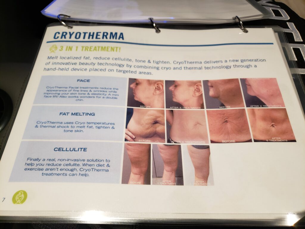 cryotherma information sheet